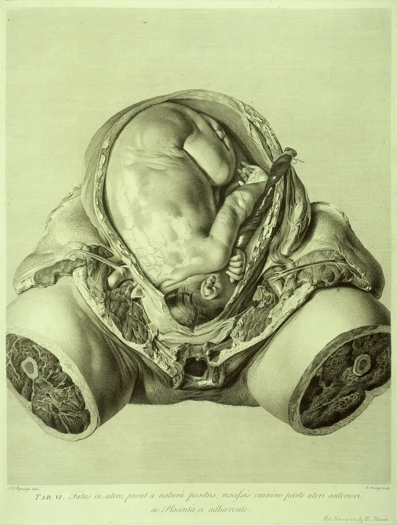 The Gravid Uterus, William Hunter, drawn by Jan van Rymsdyk
