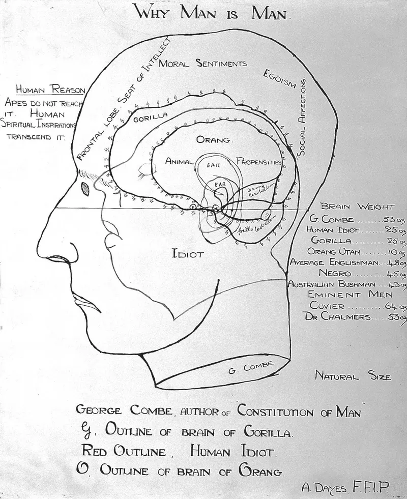 Gall's Cranioscopy, Franz Joseph Gall